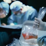 Doctors perform a kidney transplant
